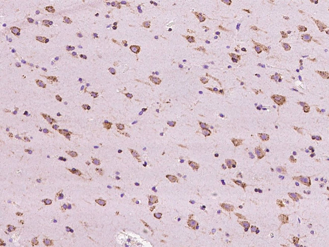 RAB5IF Antibody in Immunohistochemistry (Paraffin) (IHC (P))