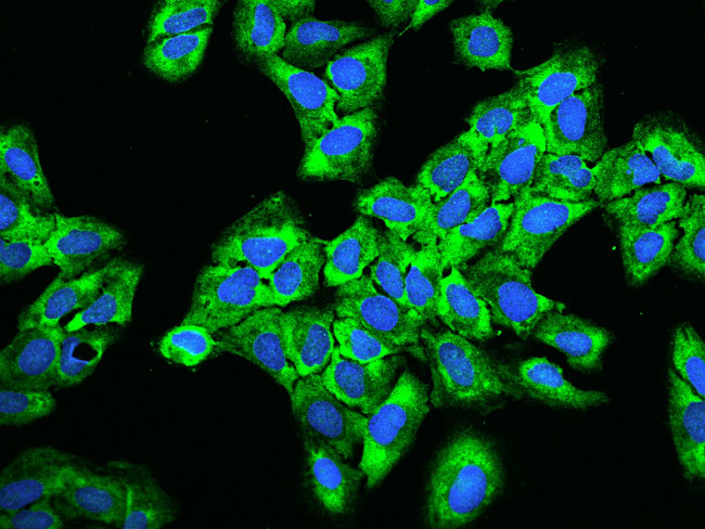 RPS5 Antibody in Immunocytochemistry (ICC/IF)