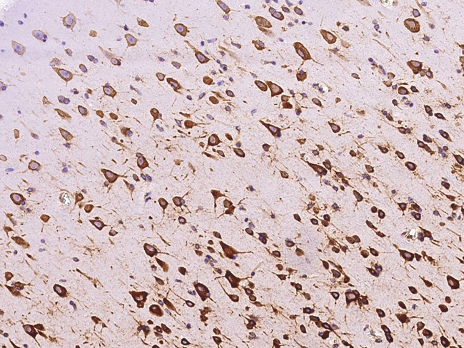 RPS5 Antibody in Immunohistochemistry (Paraffin) (IHC (P))