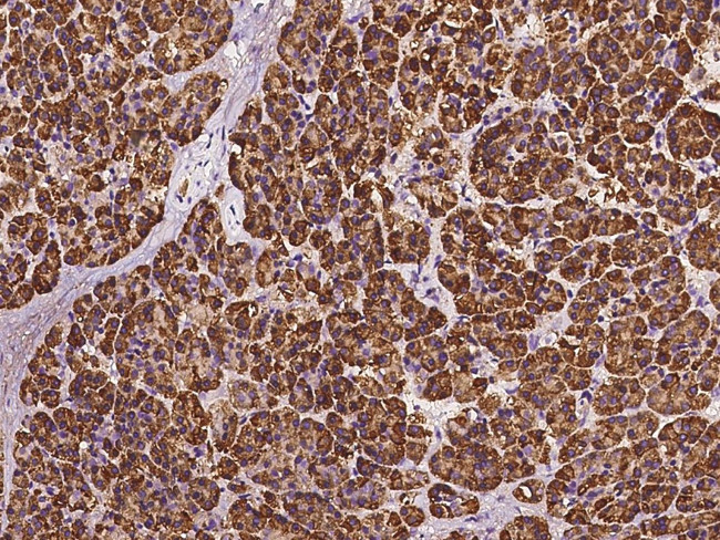 RPS5 Antibody in Immunohistochemistry (Paraffin) (IHC (P))