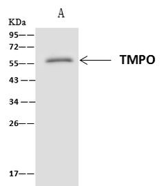 LAP2 Antibody in Immunoprecipitation (IP)