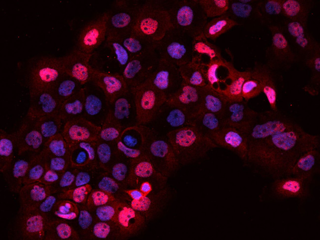 SARNP Antibody in Immunocytochemistry (ICC/IF)