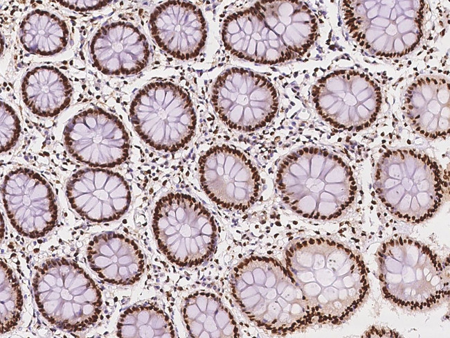 SARNP Antibody in Immunohistochemistry (Paraffin) (IHC (P))