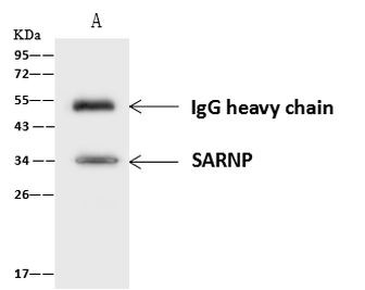 SARNP Antibody in Immunoprecipitation (IP)