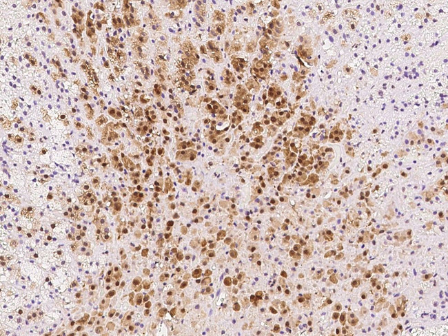 PGAM1 Antibody in Immunohistochemistry (Paraffin) (IHC (P))