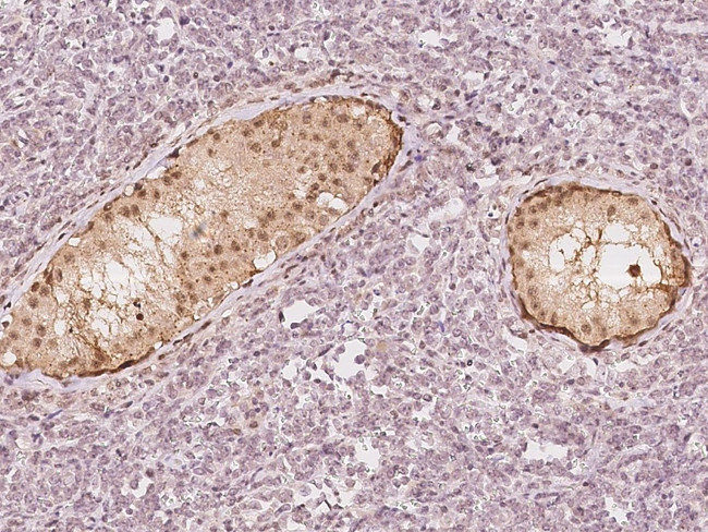 PGAM1 Antibody in Immunohistochemistry (Paraffin) (IHC (P))