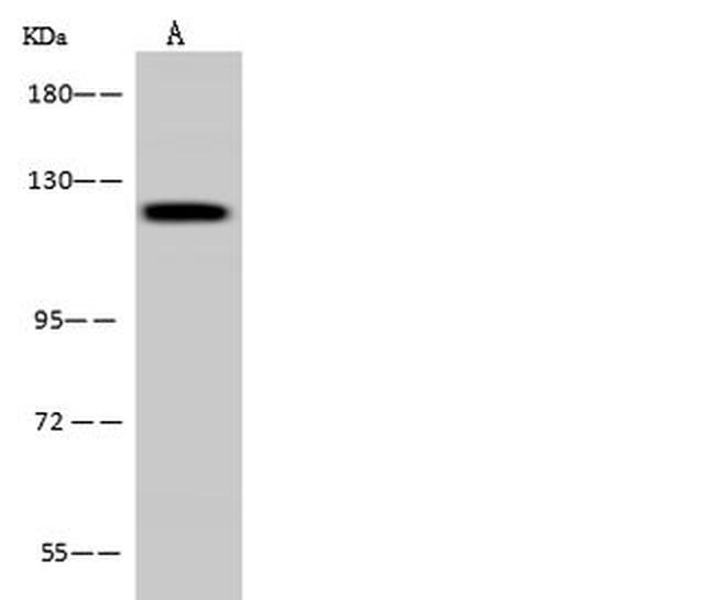 PITRM1 Antibody in Western Blot (WB)