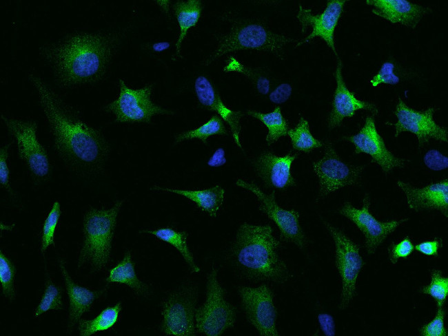 SRP72 Antibody in Immunocytochemistry (ICC/IF)