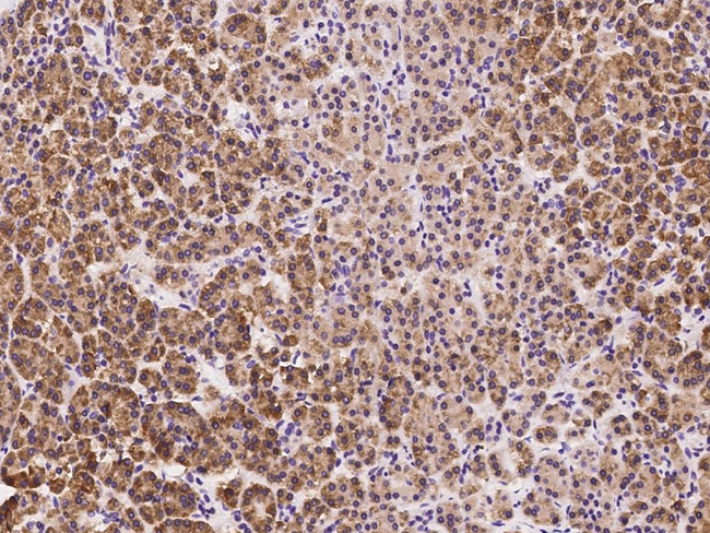 SRP72 Antibody in Immunohistochemistry (Paraffin) (IHC (P))