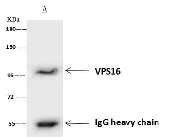 VPS16 Antibody in Immunoprecipitation (IP)
