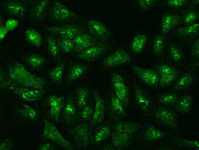 eIF3f Antibody in Immunocytochemistry (ICC/IF)