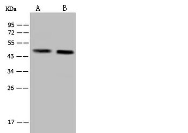 MAP1 Antibody in Western Blot (WB)