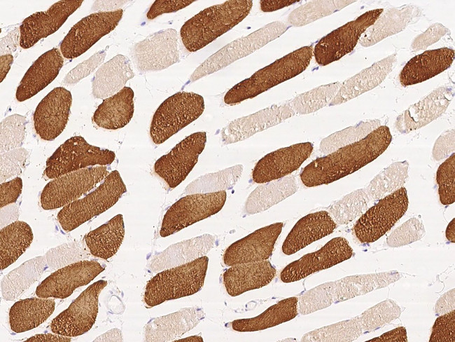 MYH7 Antibody in Immunohistochemistry (Paraffin) (IHC (P))