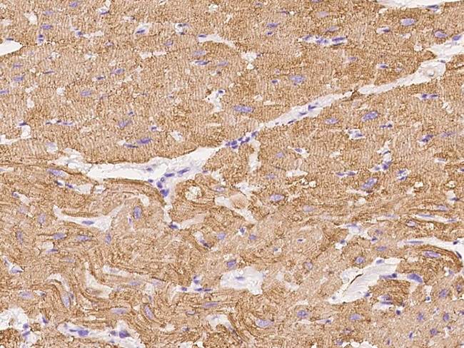 MYH7 Antibody in Immunohistochemistry (Paraffin) (IHC (P))