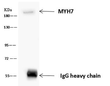 MYH7 Antibody in Immunoprecipitation (IP)