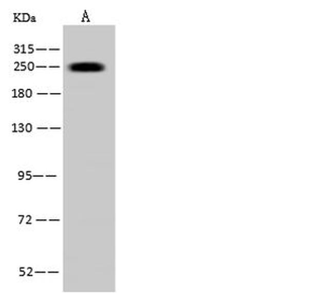 MYH7 Antibody in Western Blot (WB)