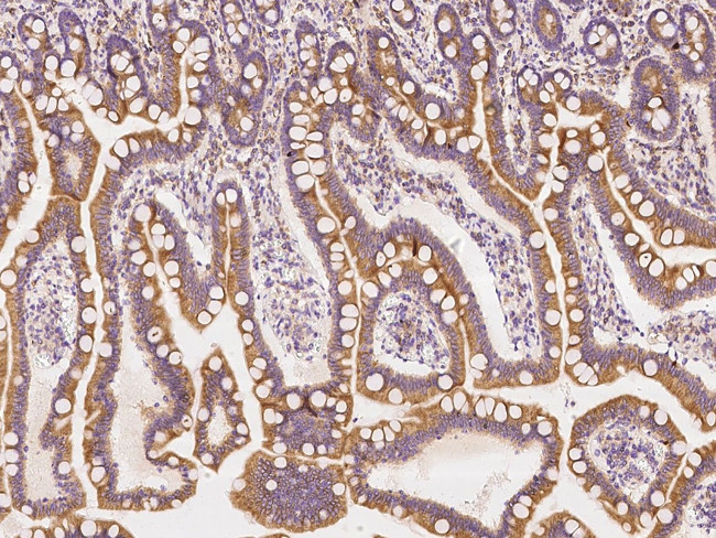 USE1 Antibody in Immunohistochemistry (Paraffin) (IHC (P))