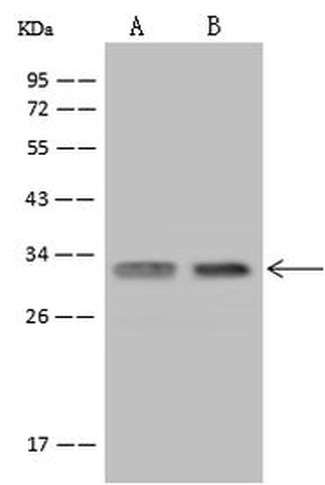 USE1 Antibody in Western Blot (WB)