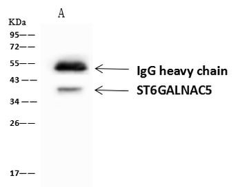 ST6GALNAC5 Antibody in Immunoprecipitation (IP)