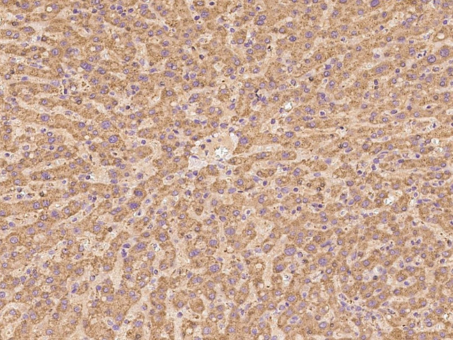 NDUFA13 Antibody in Immunohistochemistry (Paraffin) (IHC (P))