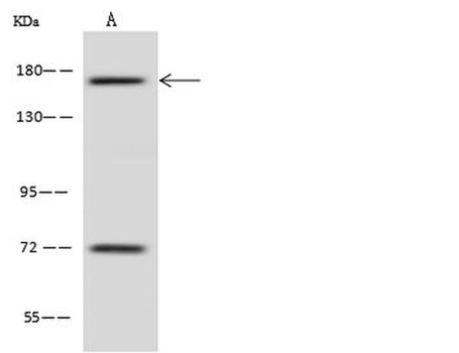 TBC1D9B Antibody in Western Blot (WB)