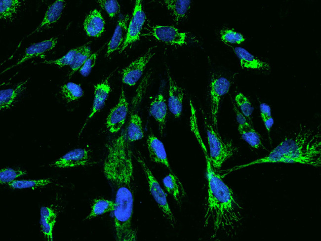 TTC19 Antibody in Immunocytochemistry (ICC/IF)