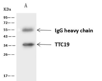 TTC19 Antibody in Immunoprecipitation (IP)