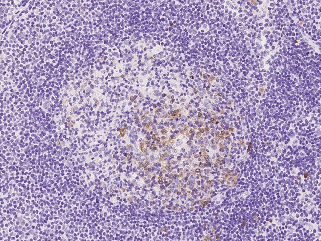 UBE2S Antibody in Immunohistochemistry (Paraffin) (IHC (P))