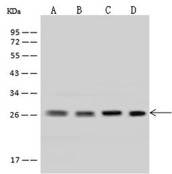 UBE2S Antibody in Western Blot (WB)