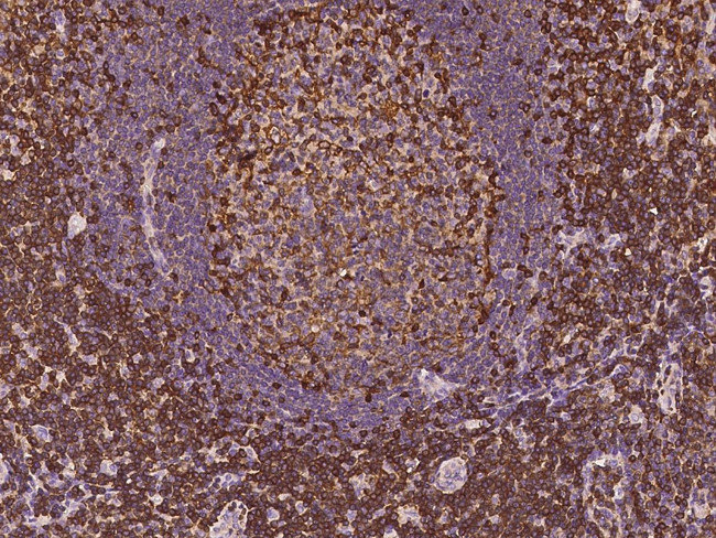 ADAP Antibody in Immunohistochemistry (Paraffin) (IHC (P))