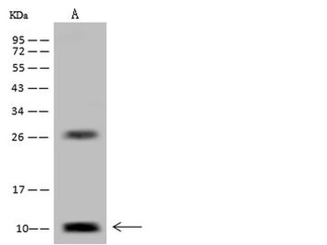 DPM2 Antibody in Western Blot (WB)
