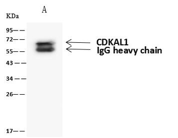 CDKAL1 Antibody in Immunoprecipitation (IP)