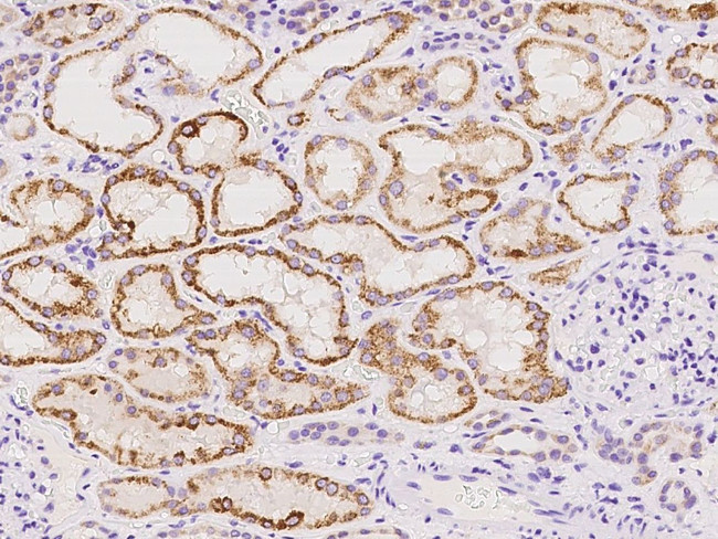 DHRS4 Antibody in Immunohistochemistry (Paraffin) (IHC (P))