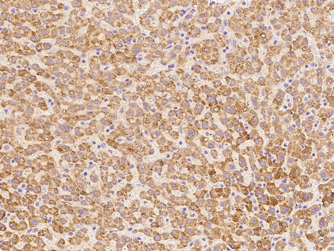 DHRS4 Antibody in Immunohistochemistry (Paraffin) (IHC (P))