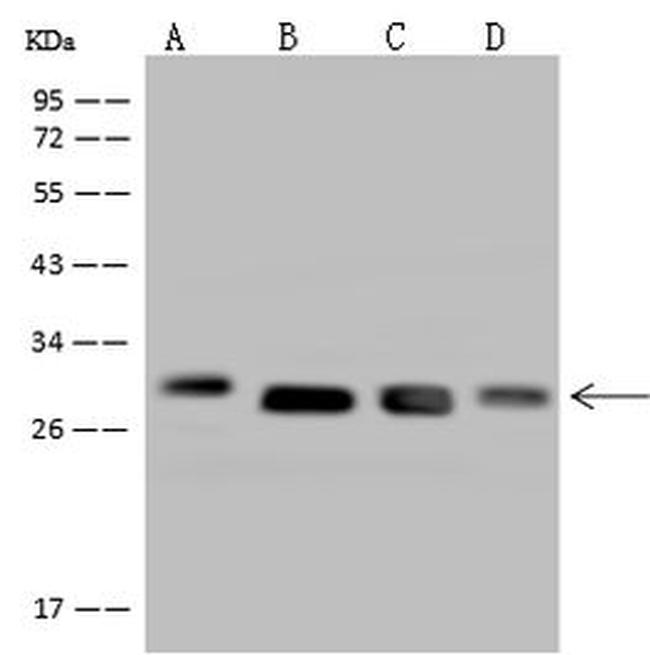 DHRS4 Antibody in Western Blot (WB)