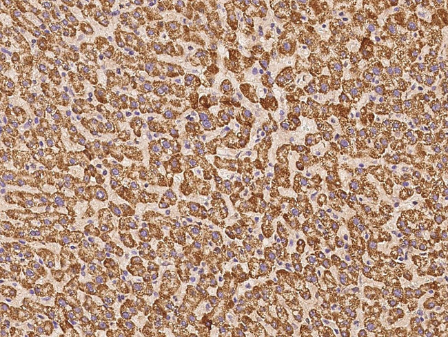 PECR Antibody in Immunohistochemistry (Paraffin) (IHC (P))