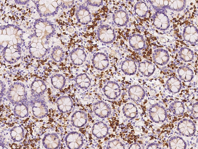 PABPC4 Antibody in Immunohistochemistry (Paraffin) (IHC (P))