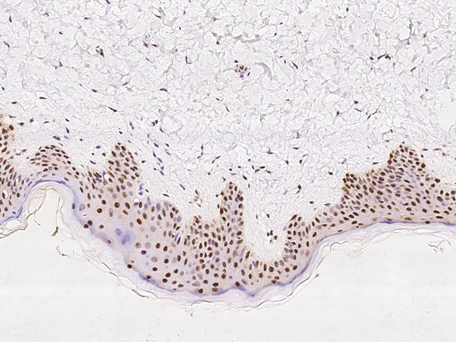 GTF2F2 Antibody in Immunohistochemistry (Paraffin) (IHC (P))