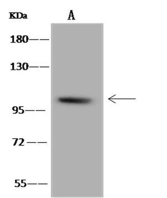 B4GALNT3 Antibody in Western Blot (WB)