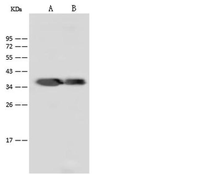 Dengue Virus Type 2 NS5 (strain New Guinea C) Antibody in Western Blot (WB)