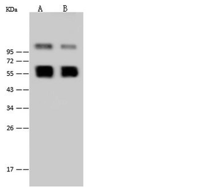 West Nile Virus NS1 (lineage 1, strain NY99) Antibody in Western Blot (WB)