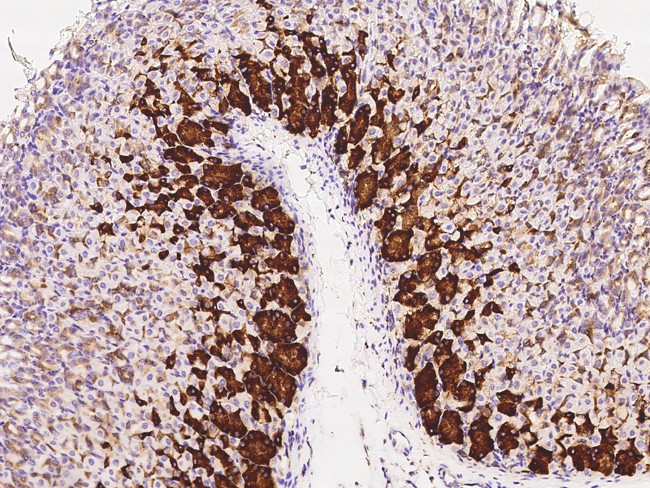 CRELD2 Antibody in Immunohistochemistry (Paraffin) (IHC (P))