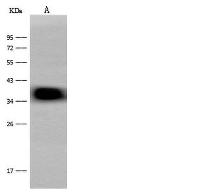 CRELD2 Antibody in Western Blot (WB)