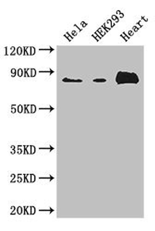 ABLIM1 Antibody in Western Blot (WB)