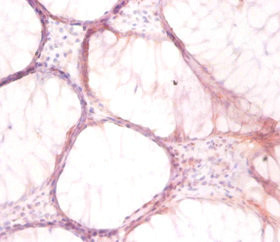 V-ATPase G1 Antibody in Immunohistochemistry (Paraffin) (IHC (P))