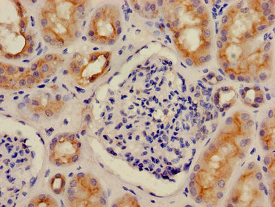 V-ATPase G1 Antibody in Immunohistochemistry (Paraffin) (IHC (P))