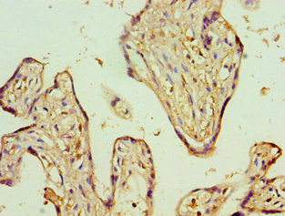 ADSS Antibody in Immunohistochemistry (Paraffin) (IHC (P))