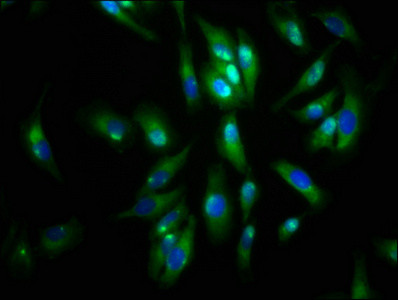 Agrin Antibody in Immunocytochemistry (ICC/IF)