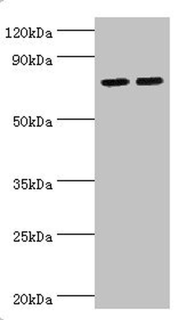 ALOX15B Antibody in Western Blot (WB)