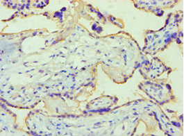 Placental Alkaline Phosphatase Antibody in Immunohistochemistry (Paraffin) (IHC (P))